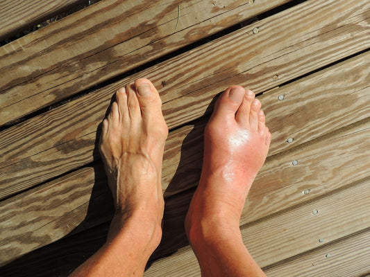 Step Into Comfort: A Guide to Surgery-Free Foot Relief - Kineon